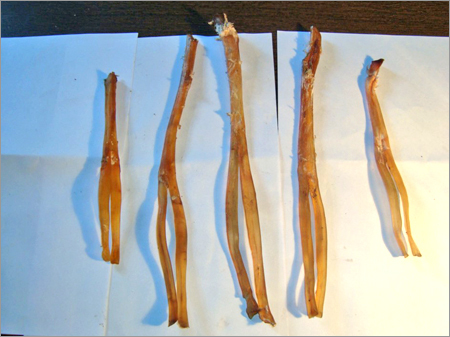 टेंडन नंबर 1