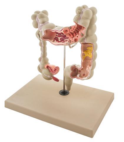 Colon