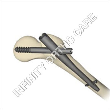 स्टील गामा नेल्स