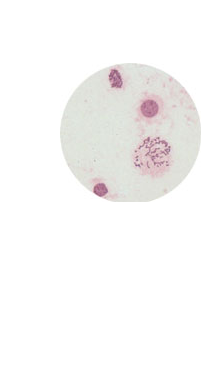 Chromosomes (400x)