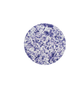 Escherichia Coli (400x)