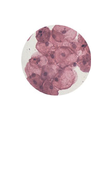 Mouth Smear (400x)