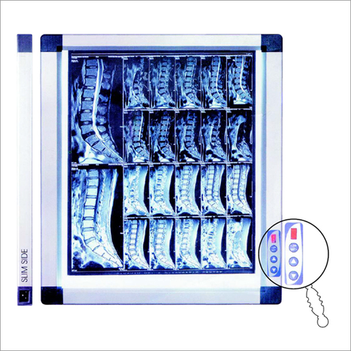 X-Ray Film Viewer