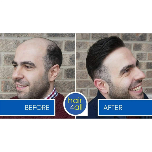 Hair Weaving Service - Human Hair & Quality Synthetic | Customizable Styles, Non-Allergenic, Volume & Length Enhancement