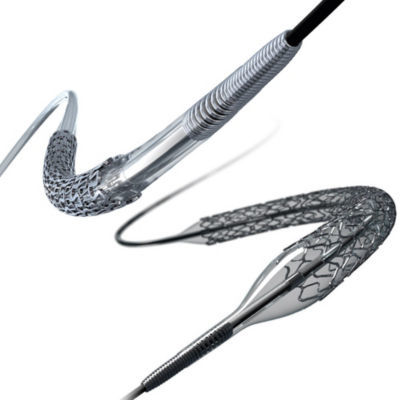 Coronary Stents