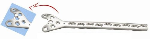 6.5 मिमी स्क्रू के लिए ताला लगाने वाली कोंडायलर बटरस प्लेट