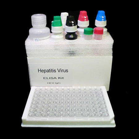HIV Aids ELISA Test Kit - Blood Antibody and Antigen Detection, Accurate Screening for Multiple Infections