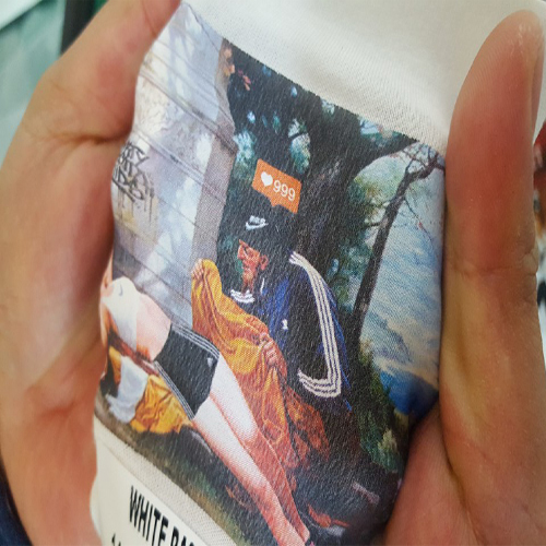 Uni-laser-screen Film Length: 33 Millimeter (Mm)