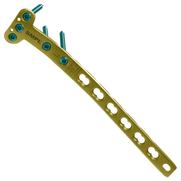 Proximal Medial Tibia Locking Plate Head Diameter: 3.5 Millimeter (Mm)