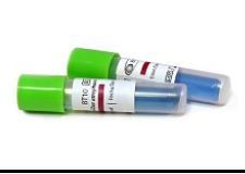 उबलने वाला बंध्याकरण उपकरण Bt101 F1