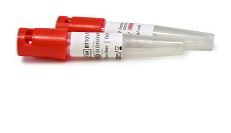 उबलने वाला बंध्याकरण उपकरण Bt101