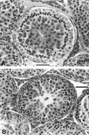 एम-डिनिट्रोबेंजीन (संश्लेषण के लिए) कैस संख्या: 99-65-0