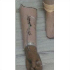 बीई प्रोस्थेटिक्स