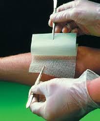 Paraffin Gauze Dressing - Gauze & Paraffin, 10x10 Inch, White | Economical, Effective, Infection Prevention, Soft Paraffin Coating, Wound Protection