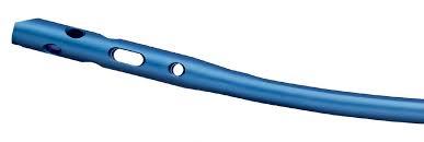 परफेक्ट टिबियल नेल ए कैनुलेटेड