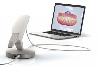 White Trios 3 In 1 Digital Impression Scanning