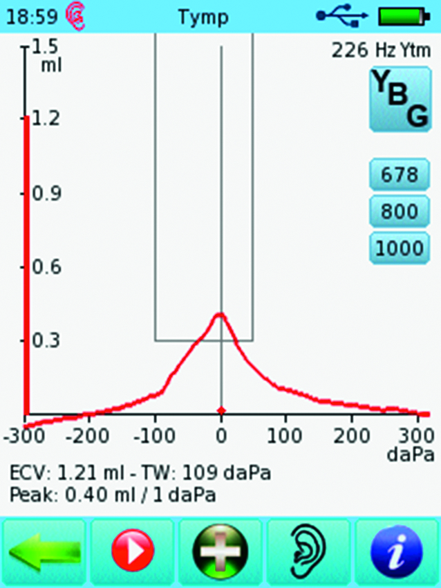Tympanometer Sentiero Desktop