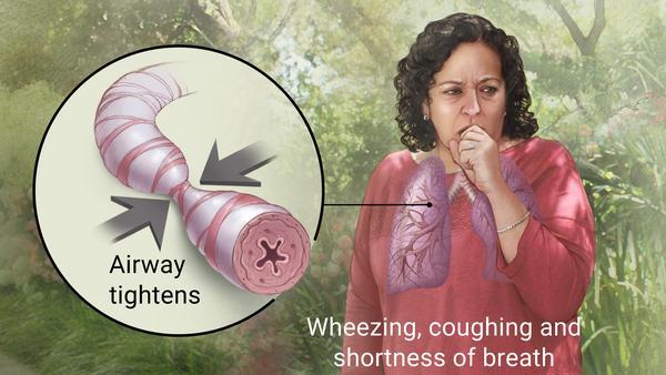 Allergy, Asthma & Immunology Diagnosis & Treatment