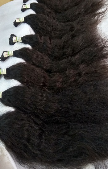One Donor Temple Hair