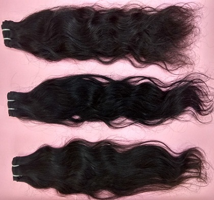 One Donor Temple Hair