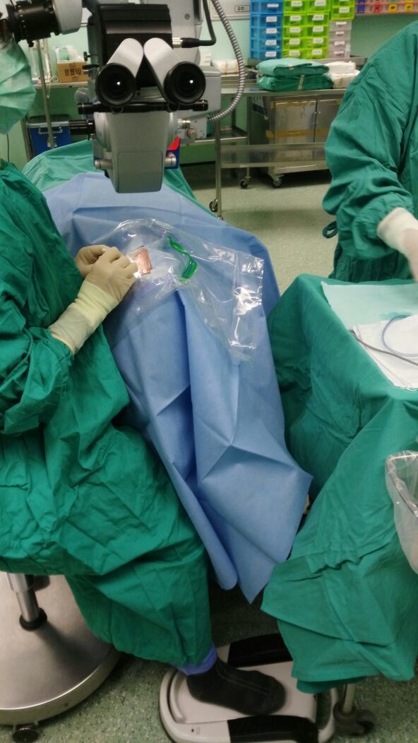 Eye Drape - Smms Non Woven, 60x60cm Square | 1 Litre Fluid Collection, Eo Gas Sterilized, Waterproof, Medical Grade, Disposable