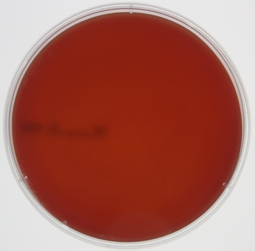 ब्लड एगर बेस एप्लीकेशन: Na