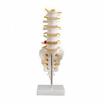 Life-size Lumbar Vertebrae With Sacrum & Coccyx And Herniated Disc