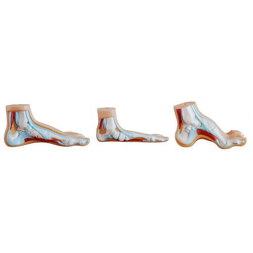 Normal,Flat and Arched Foot (Model)