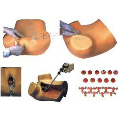 Gynaecological Examination Model