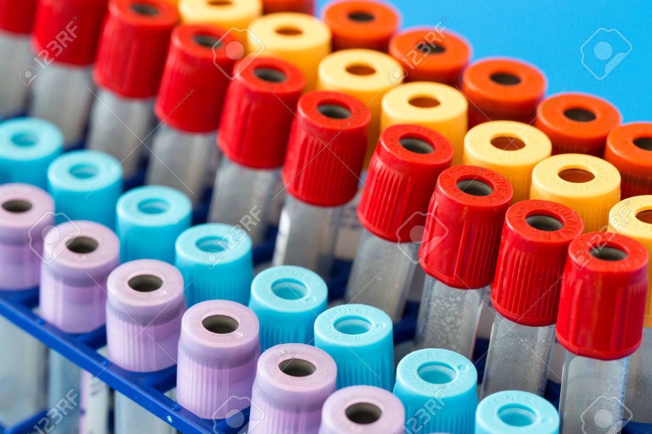 Vacuum Blood Collection Tubes - Glass/plastic, 13x75mm Size, Red Color, 2-10ml Capacity With Rubber Stopper