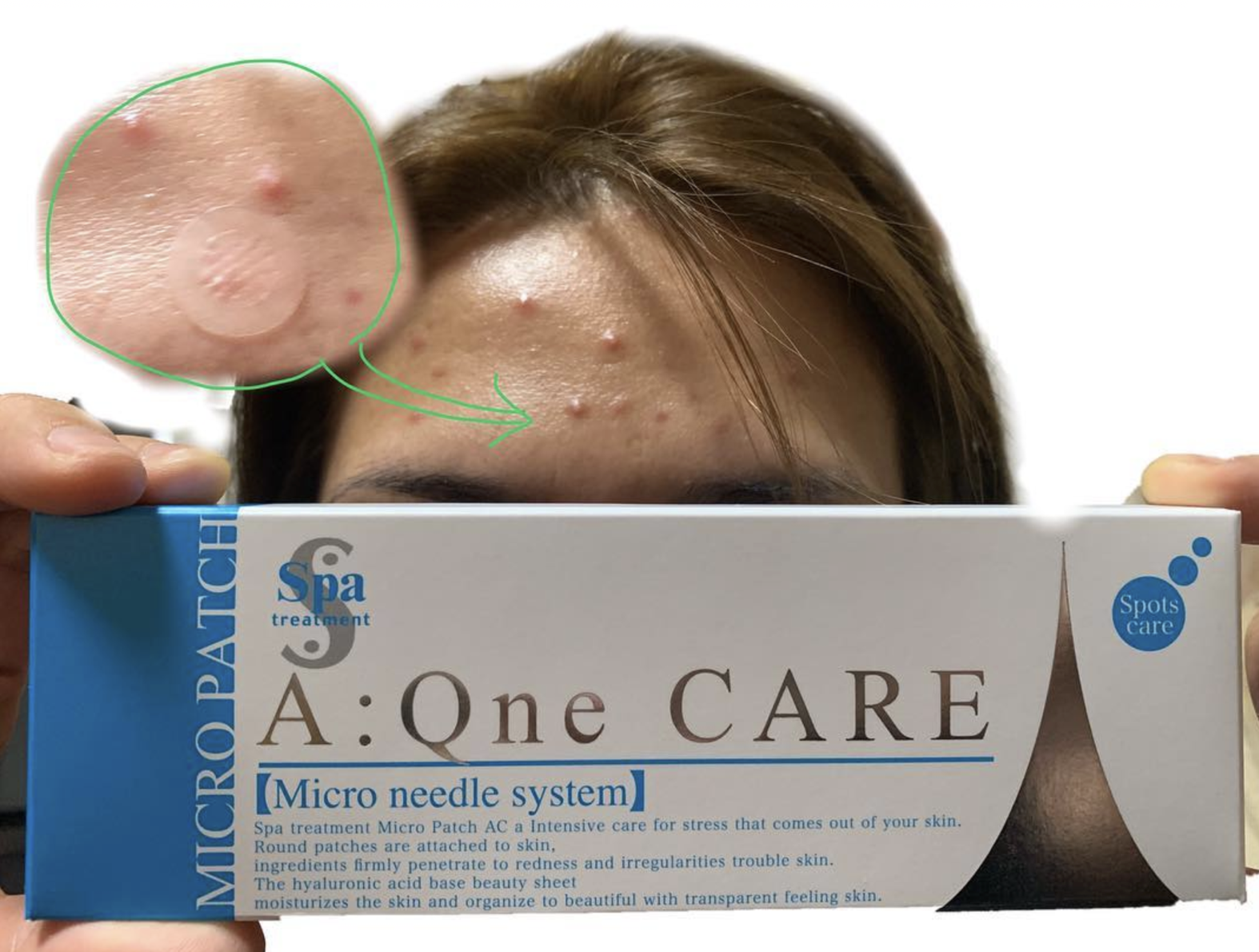 Micro Patch Acne Care, 6 Sheets - Spa Treatment Age Group: All Ages