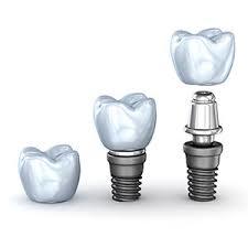Dental