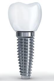 Dental