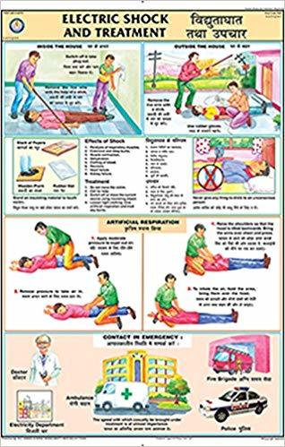 Electric Shock Treatment Chart