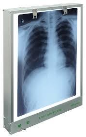 X-ray Viewer Age Group: Elders