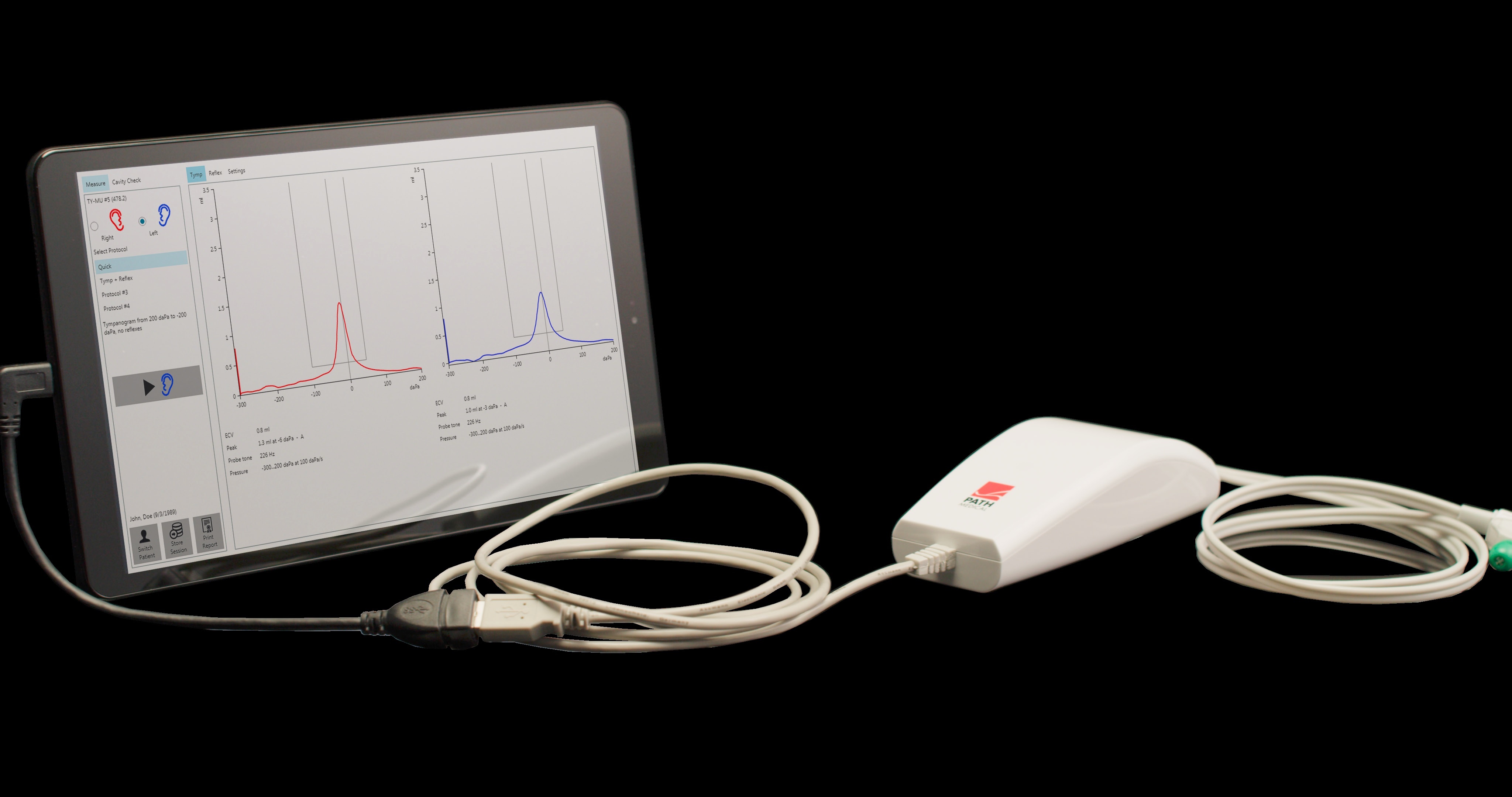 Screening Tympanometer
