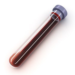Test Tubes - Borosilicate Glass, 100x12 mm | Clear Sterile, Screw Cap Closure, 5-10 ml Capacity for Laboratory Sample Containment and Blood Storage