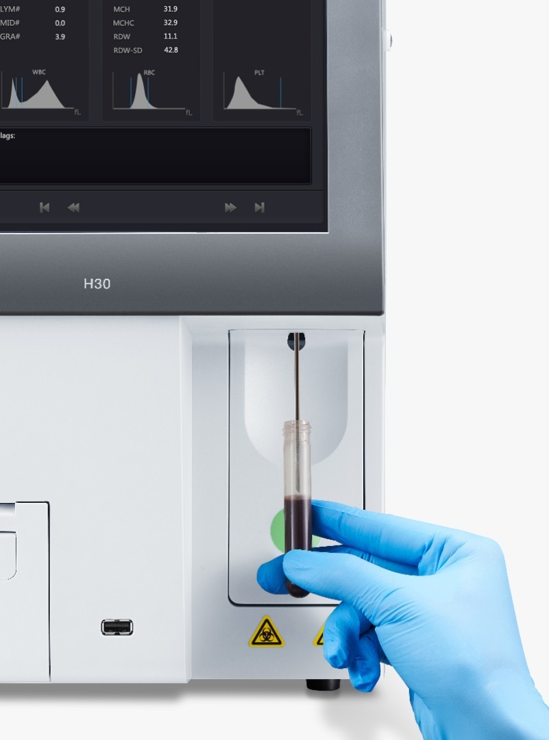 Edan 3 Part Hematology Analyzer Application: Cell Counter