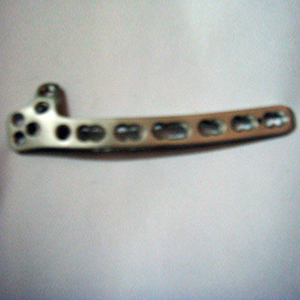 Stainless Steel Distal Humerus Dorsolateral With Support