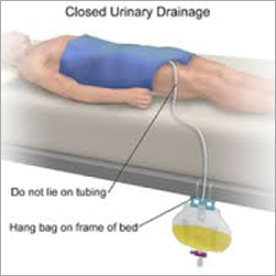 प्लास्टिक क्लोज्ड यूरिनरी ड्रेनेज