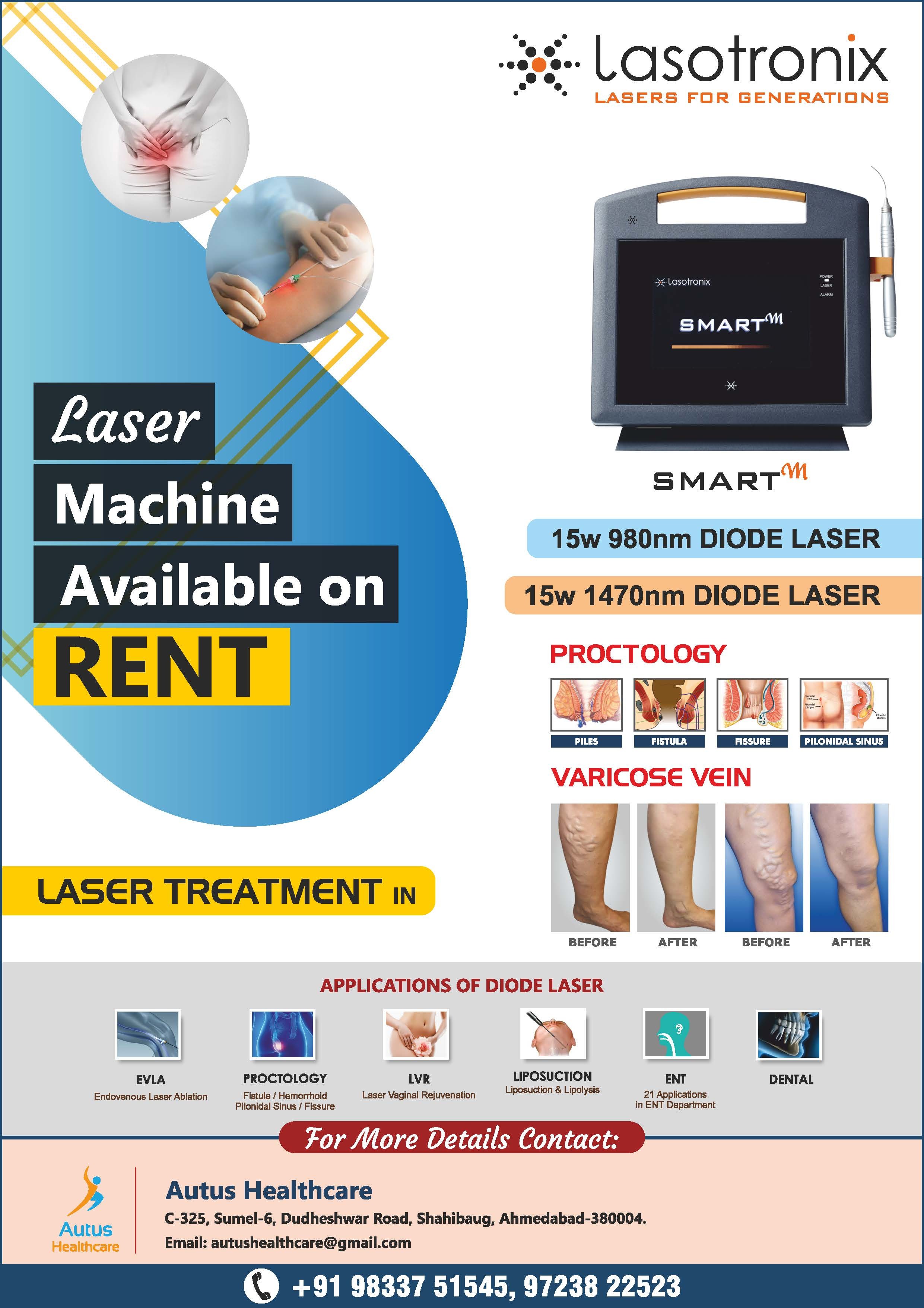 Lasotronix Laser On Rent For Varicose Veins And Proctology