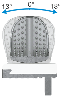 Partial Knee Replacement