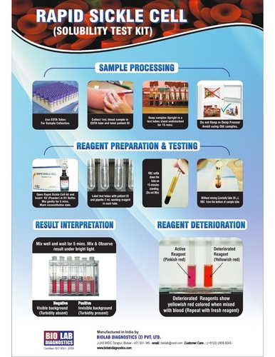 Rapid Sickle Cell Detection Reagent - Liquid Form, 24 Months Shelf Life | Detect Sickle Cell Anemia in Red Blood Cells, Room Temperature Storage