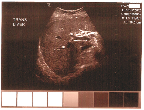 Ultrasound Thermal Paper same as national brand