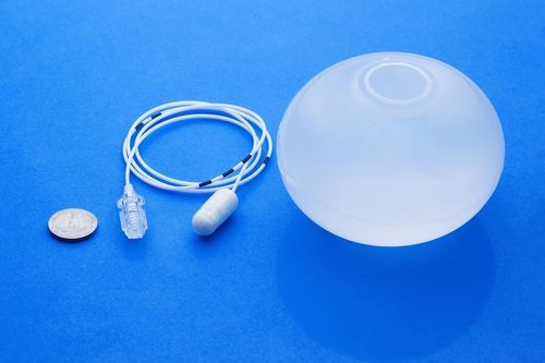 Intragastric Balloon