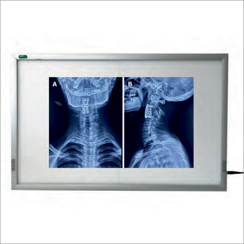X-Ray Viewer - Aluminum, 14 x 17 Inches | LED Light Source, 1000 Lux Brightness, 100 Watts Power Consumption, 1 Year Warranty