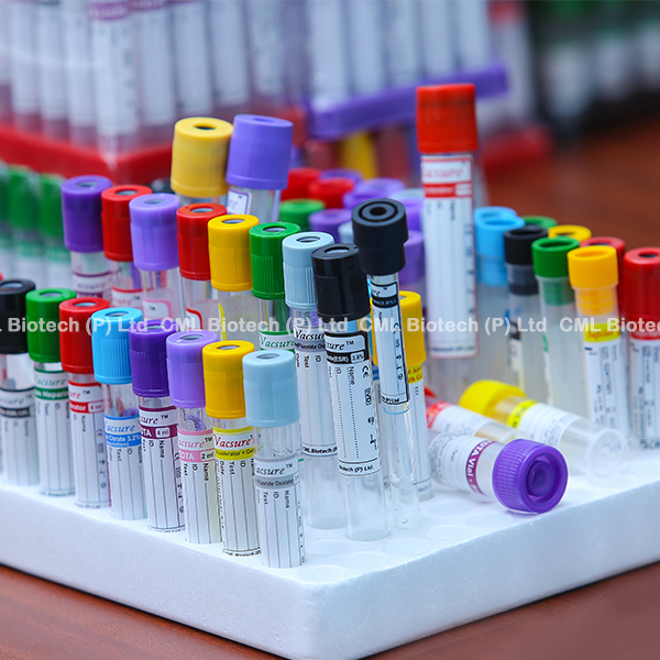 Vacsure Sodium Citrate 3.2% Tubes (Pt Tubes)