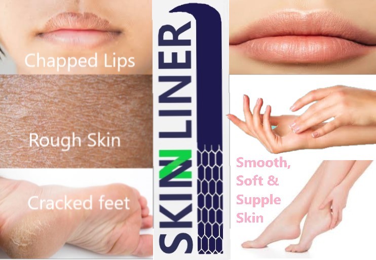 Skinnliner White Petroleum Jelly 50 Gm Age Group: 5-80