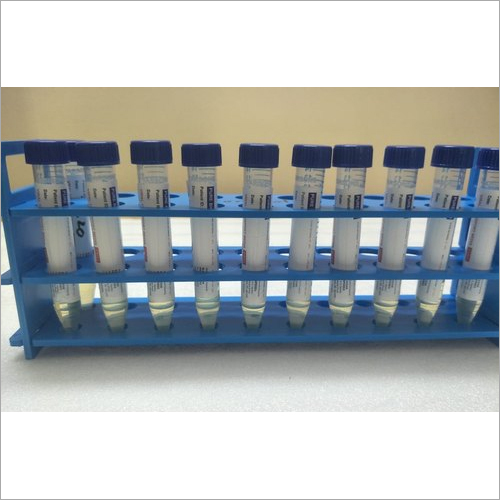 Vtm Kit - Plastic Material, 1 Reaction Per Kit | Viral Transport Medium, Test Tube, Swab