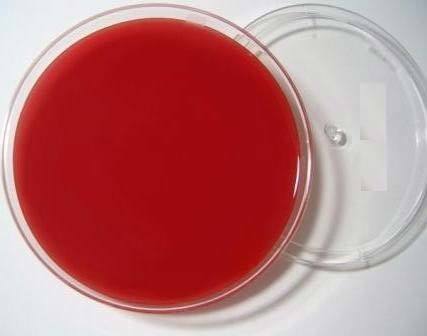 Sheep Blood Agar Plates - 500 Milliliter Plastic , 50 Plates For Growing Fastidious Organisms And Differentiating Bacteria By Hemolytic Properties